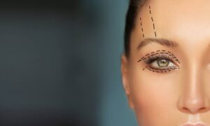 Upper vs Lower Eyelid Surgery Know the Difference