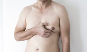 Male Breast Reduction Safe Fast & Affordable in Islamabad