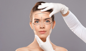 Blepharoplasty in Islamabad – Say Goodbye to Eye Bags for Good